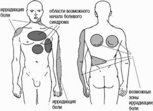 Локализация боли в области груди