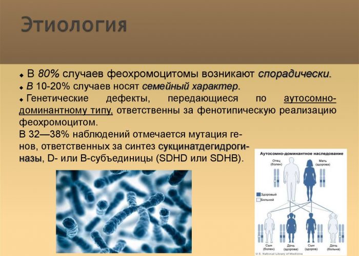 Выраженная феохромоцитома
