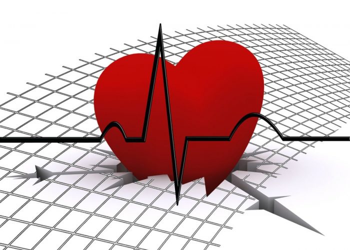 Наличие угрозы развития ишемической болезни сердца