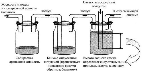 Дренирование плевральной полости