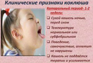 Сухой кашель у детей является признаком коклюша