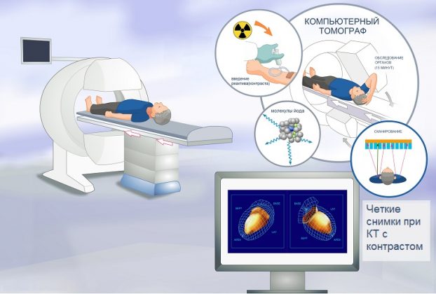Как работает КТ