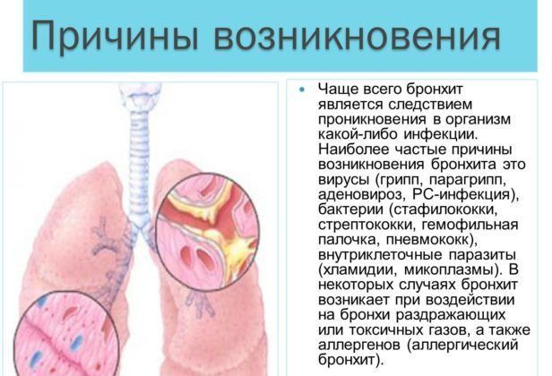 Основные причины появления бронхита