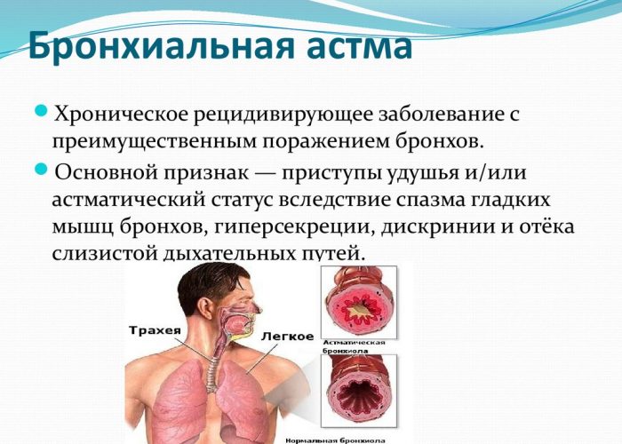 Бронхиальной астмой