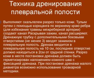 Техника дренирования плевральной полости