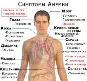 Симптомом бронхита является анемия 