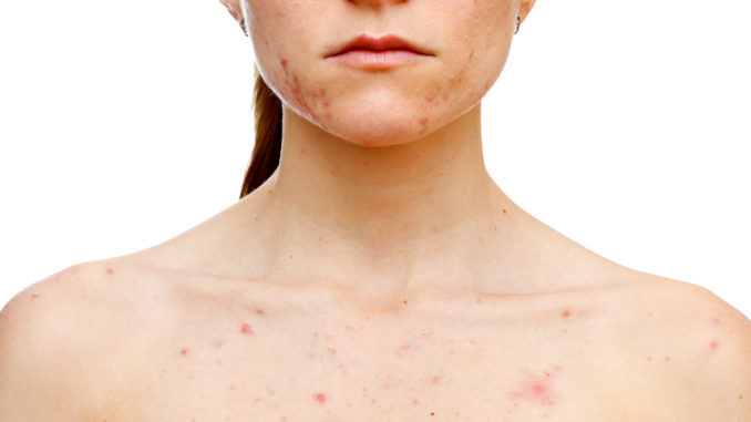 сильная аллергия по всему телу