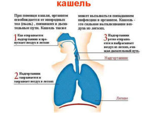 Главным симптомом аллергического бронхита является кашель
