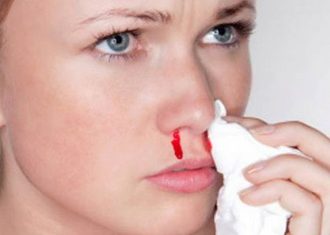 Частые носовые кровотечения