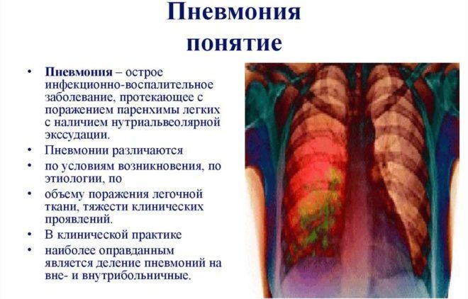 Пневмония часта вызывает сухой кашель