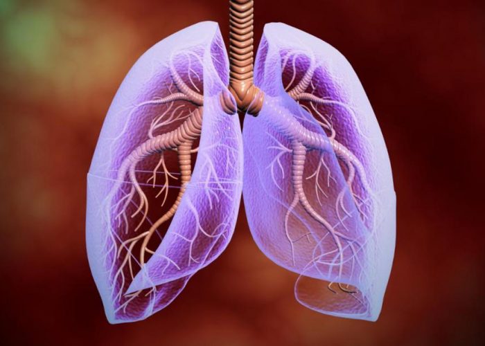 Обструктивная болезнь лёгких