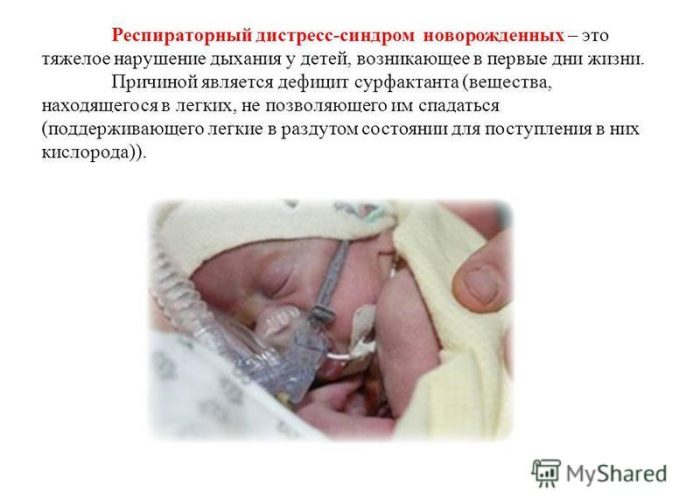 Расстройство дыхания у новорожденных