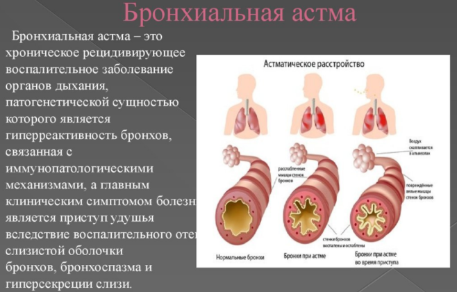 При бронхиальной астме мазь запрещена