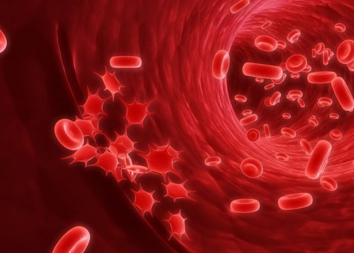 Патологии кроветворной системы