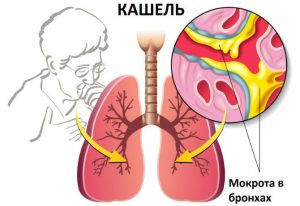 О чем свидетельствует кашель