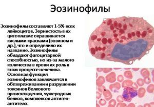 Дифференциация эозинофильного инфильтрата