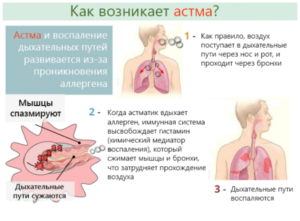 Коделак запрещен при астме 