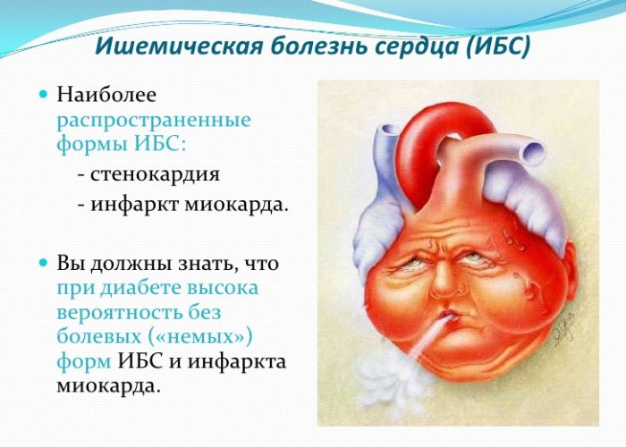 Ишемической болезни сердца