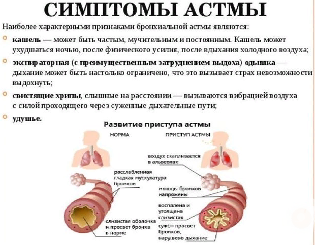 Симптоматика бронхиальной астмы