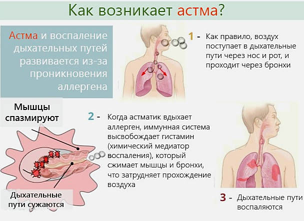 Длительный кашель при астме