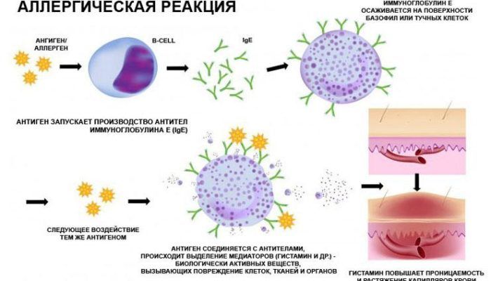 Аллергическая реакция