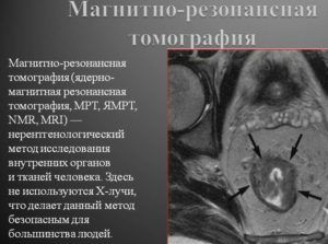 МРТ для диагностики возникновения свиста при вдохе